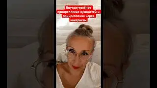 ВНУТРИУТРОБНОЕ ПРИКРЕПЛЕНИЕ СУЩНОСТЕЙ И ПРИКРЕПЛЕНИЕ ЧЕРЕЗ КОНТРАКТЫ.