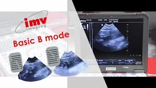 How to use the Mindray M6 video 2 - Basic B mode settings