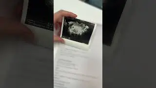 У меня есть бебик ❤️