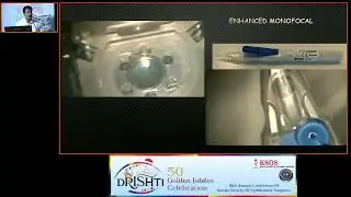 KSOS2023   GP18  Topic Dr Anish Madhavan  Enhanced Monofocal IOLs – Are they really EDOF lenses