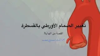 تغيير الصمام الأورطي بالقسطرة, القصة كاملة!
