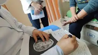 腦瘤醫生判讀