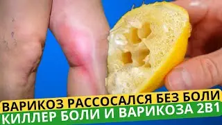 Попрощайтесь с варикозным расширением вен и болями в суставах только с 2 натуральными ингредиентами