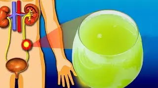 راه های جلوگیری از مسدود شدن مثانه و کلیه و پیشگیری از پیر شدن کلیه ها و مثانه