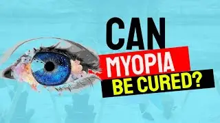 Is Myopia Reversible Without Surgery Can Myopia Be Cured Permanently Official Video