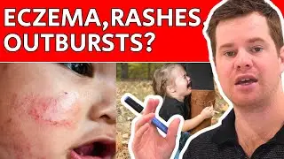 Fix Your Child's Skin & Mood Issues (Naturally!) | Evan Brand