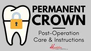 What To Do After Getting a Permanent Crown | #experienceHFD