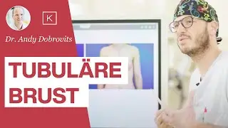 Tubuläre Brust / Schlauchbrust: Was ist das wirklich & ist eine OP möglich? (inkl. 📸 Vorher Nachher)