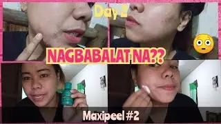 MAXIPEEL EXFOLIANT SOLUTION DAY 2 | NAGBABALAT NA SIYA 😔