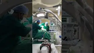 Cervical spine fixation 😮 #support #youtubeshorts