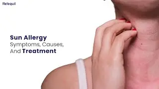 Sun Allergy Symptoms, Causes, And Treatment