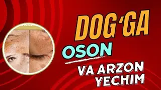 Dog'ga arzon va oson yechim