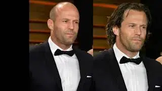 popular bald actors with hairy head
