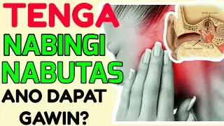Tenga: Nabutas, Nabingi, Nahilo: Tamang Gamutan - Tips ni Doc Willie Ong 