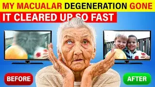 Top 8 Essential Nutrients to Combat Macular Degeneration After 50