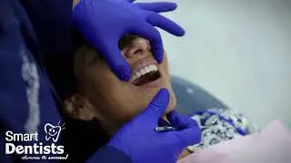 Testimonio por Implantes Dentales 🦷 Clínica Smart Dentists