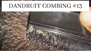 DANDRUFF COMBING #13