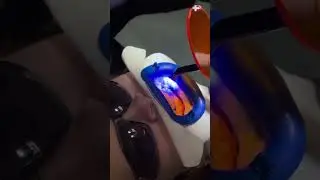 Отбеливание Zoom4