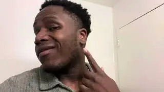 Minoxidil 30 Day Update