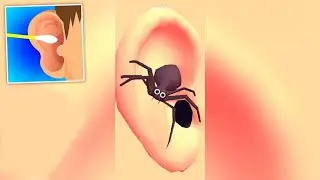 Earwax Clinic Pro Levels Gameplay Walkthrough iOS,Android  Newtrailers Pro Mobile Game Update SDT18N