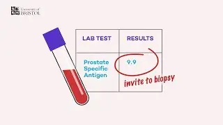 One-off PSA screening for prostate cancer does not save lives