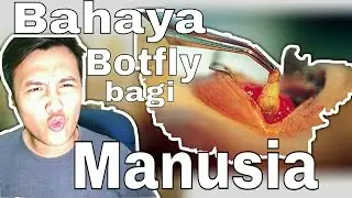 Awalnya bentol bisul isinya ternyata... Ngeri