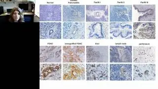 Kimberly Kelly - Development of molecularly targeted imaging agents and identification of novel targ