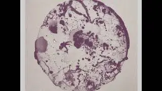 Lawrence - Interference  (Giegling 27)