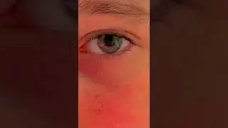 У меня вообще глаза меняют цвет из зеленого в голубой иногда✌️