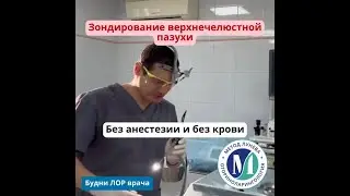 Зондирование при гайморите.