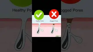 Most Common Problem Part:01