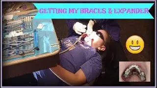 GETTING MY BRACES & EXPANDER