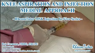 Knee Aspiration and Injection - Medial Approach - In Vivo Series