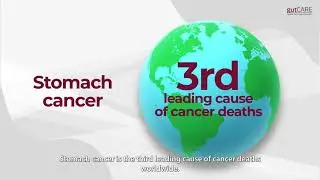 Stomach Cancer 101 | GUTCARE