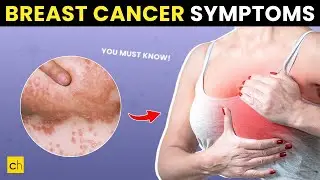 Breast Cancer Symptoms You MUST Know! Early Detection Saves Lives!