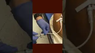 Traumatic Knee Dislocation Reduction