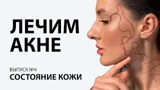 Состояние кожи
