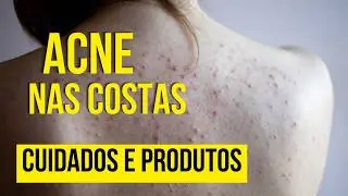 ESPINHAS NAS COSTAS - ACABE, entenda e conheça os produtos para tratar