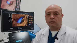 Sonoscape P40 Elite. Testimonio para Hospitalar.