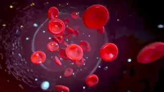 Claudication