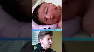 Tohle dítě má 2 HLAVY!! 😱👶🏻