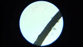 Cell Phone Adapter for Microscope Test#2