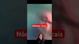Mulher que gosta de gritar: Calos nas cordas vocais!