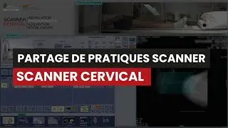 CT Scanner CERVICAL - Partage de pratiques