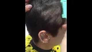 asian girl headshave before after