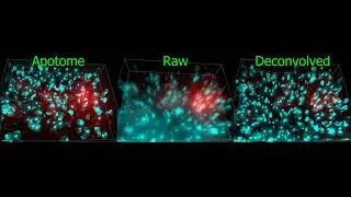 Apotome vs Deconvolution for widefield fluorescence