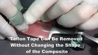 The Ultimate Posterior Composite Technique