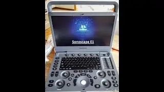 FOVU review of Sonoscape E1V