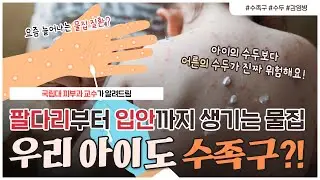 아이의 손발톱이 빠진다고...?!😥 | 발열부터 물집까지, 엄마도 괴롭히는 수족구😰 완벽하게 정리해드립니다👩🏻‍⚕️ - [언니네피부과]