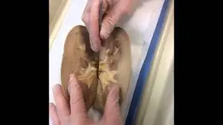 Lab  Kidney Dissection